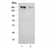 Western blot testing of human 1) U-87 MG and 2) Caco-2 cell lysate with SHROOM4 antibody. Predicted molecular weight ~165 kDa.