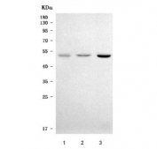Western blot testing of human 1) HepG2, 2) HCCT and 3) HUH-7 cell lysate with Alpha-1-Antichymotrypsin antibody. Expected molecular weight: 47-65 kDa, depending on level of glycosylation.