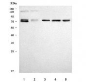 Western blot testing of 1) human HepG2, 2) human HCCT, 3) rat liver, 4) rat RH35 and 5) mouse liver tissue lysate with SERPINA10 antibody. Predicted molecular weight: ~51 kDa but may be observed at higher molecular weights due to glycosylation.