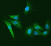 Immunofluorescent staining of FFPE human A549 cells with Leukocyte elastase inhibitor antibody (green) and DAPI nuclear stain (blue). HIER: steam section in pH6 citrate buffer for 20 min.