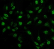 Immunofluorescent staining of FFPE human HeLa cells with PIN1 antibody (green). HIER: steam section in pH6 citrate buffer for 20 min.