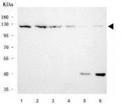 Western blot testing of 1) human HeLa, 2) human MOLT4, 3) human 293T, 4) human A431, 5) rat brain and 6) mouse brain tissue lysate with RNF20 antibody. Predicted molecular weight ~114 kDa.