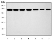 Western blot testing of human 1) HeLa, 2) Jurkat, 3) K562, 4) 293T, 5) U-251, 6) Daudi and 7) MOLT4 cell lysate with SF3a120 antibody. Predicted molecular weight ~89 kDa but commonly observed at ~120 kDa.
