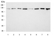 Western blot testing of 1) rat lung, 2) rat brain, 3) rat thymus, 4) rat C6, 5) mouse lung, 6) mouse brain, 7) mouse thymus and 8) mouse Neuro-2a cell lysate with SF3a120 antibody. Predicted molecular weight ~89 kDa but commonly observed at ~120 kDa.