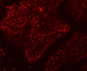 Immunofluorescent staining of FFPE rat colon tissue with SF3a120 antibody. HIER: steam section in pH8 EDTA buffer for 20 min.