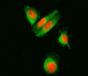 Immunofluorescent staining of FFPE human PC-3 cells with SF3a120 antibody (red) and Alpha Tubulin mAb (red). HIER: steam section in pH6 citrate buffer for 20 min.