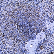 IHC staining of FFPE human spleen tissue with SF3a120 antibody. HIER: boil tissue sections in pH8 EDTA for 20 min and allow to cool before testing.