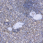 IHC staining of FFPE human spleen tissue with SF3a60 antibody. HIER: boil tissue sections in pH8 EDTA for 20 min and allow to cool before testing.