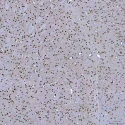 IHC staining of FFPE mouse brain tissue with SF3a60 antibody. HIER: boil tissue sections in pH8 EDTA for 20 min and allow to cool before testing.