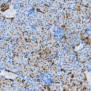 IHC staining of FFPE mouse kidney tissue with SF3a60 antibody. HIER: boil tissue sections in pH8 EDTA for 20 min and allow to cool before testing.
