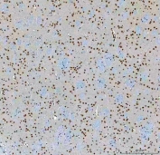 IHC staining of FFPE rat brain tissue with SF3a60 antibody. HIER: boil tissue sections in pH8 EDTA for 20 min and allow to cool before testing.