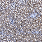 IHC staining of FFPE rat kidney tissue with SF3a60 antibody. HIER: boil tissue sections in pH8 EDTA for 20 min and allow to cool before testing.