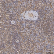 IHC staining of FFPE human spleen tissue with Sideroflexin-3 antibody. HIER: boil tissue sections in pH8 EDTA for 20 min and allow to cool before testing.