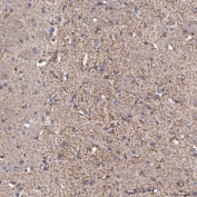 IHC staining of FFPE mouse brain tissue with Sideroflexin-5 antibody. HIER: boil tissue sections in pH8 EDTA for 20 min and allow to cool before testing.