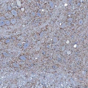 IHC staining of FFPE rat cerebellum tissue with Sideroflexin-5 antibody. HIER: boil tissue sections in pH8 EDTA for 20 min and allow to cool before testing.