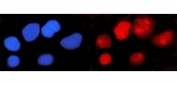 Immunofluorescent staining of FFPE human U-251 cells with IFI16 antibody (red) and DAPI nuclear stain (blue). HIER: steam section in pH6 citrate buffer for 20 min.