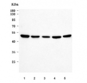 Western blot testing of 1) human 293T, 2) human HeLa, 3) human Raji, 4) rat RH35 and 5) mouse NIH 3T3 cell lysate with RNA-binding protein 22 antibody. Predicted molecular weight ~47 kDa.