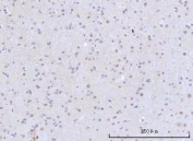 IHC staining of FFPE rat brain tissue with RNA-binding protein 22 antibody. HIER: boil tissue sections in pH8 EDTA for 20 min and allow to cool before testing.