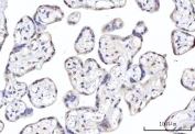 IHC staining of FFPE human placental tissue with RNA-binding protein 22 antibody. HIER: boil tissue sections in pH8 EDTA for 20 min and allow to cool before testing.