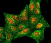 Immunofluorescent staining of FFPE human U-2 OS cells with RASSF2 antibody (red) and Alpha Tubulin mAb (green). HIER: steam section in pH6 citrate buffer for 20 min.