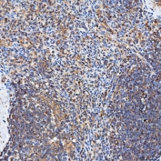 IHC staining of FFPE human spleen tissue with SH2D4A antibody. HIER: boil tissue sections in pH8 EDTA for 20 min and allow to cool before testing.