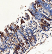 IHC staining of FFPE rat gastric tissue with SH2D4A antibody. HIER: boil tissue sections in pH8 EDTA for 20 min and allow to cool before testing.