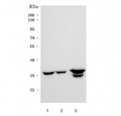 Western blot testing of human 1) A549, 2) K562 and 3) U-87 MG cell lysate with ANXA1 antibody. Predicted molecular weight ~36 kDa.