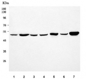 Western blot testing of 1) human U-2 OS, 2) human MCF7, 3) human K562, 4) rat testis, 5) rat heart, 6) mouse testis and 7) mouse heart tissue lysate with RNF216 antibody. Predicted molecular weight ~99, ~106 and ~57 kDa (three isoforms).