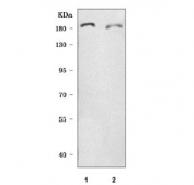 Western blot testing of human 1) Caco-2 and 2) MCF7 cell lysate with SHROOM2 antibody. Predicted molecular weight ~176 kDa.