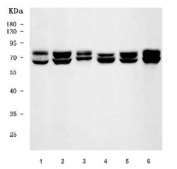 Western blot testing of 1) human placenta, 2) human HeLa, 3) human A431, 4) rat lung, 5) mouse lung and 6) mouse small intestine tissue lysate with Lamin A/C antibody. Predicted molecular weight ~74 kDa (A) & 65 kDa (C).