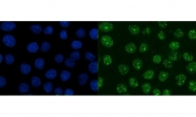 Immunofluorescent staining of FFPE human A431 cells with XRCC1 antibody (green) and DAPI nuclear stain (blue). HIER: steam section in pH6 citrate buffer for 20 min.