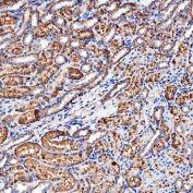 IHC staining of FFPE rat kidey tissue with NHERF-2 antibody. HIER: boil tissue sections in pH8 EDTA for 20 min and allow to cool before testing.
