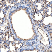 IHC staining of FFPE rat lung tissue with NHERF-2 antibody. HIER: boil tissue sections in pH8 EDTA for 20 min and allow to cool before testing.
