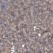 IHC staining of FFPE mouse kidney tissue with NHERF-2 antibody. HIER: boil tissue sections in pH8 EDTA for 20 min and allow to cool before testing.