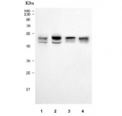 Western blot testing of 1) human MCF7, 2) human T-47D, 3) human PC-3 and 4) mouse lung tissue lysate with NHERF-2 antibody. Predicted molecular weight ~37 kDa, commonly observed at 35-45 kDa.
