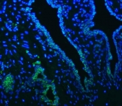 Immunofluorescent staining of FFPE human prostate cancer tissue with SLC22A8 antibody (green) and DAPI nuclear stain (blue). HIER: steam section in pH8 EDTA buffer for 20 min.
