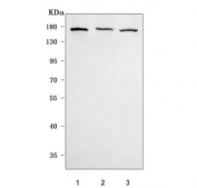 Western blot testing of 1) human U-87 MG, 2) human 293T and 3) rat C6 cell lysate with mGluR5 antibody. Predicted molecular weight ~132 kDa but may be observed at higher molecular weights due to glycosylation.