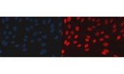 Immunofluorescent staining of FFPE human U-2 OS cells with BAF57 antibody (red) and DAPI nuclear stain (blue). HIER: steam section in pH6 citrate buffer for 20 min.