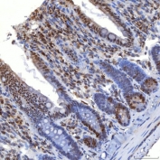 IHC staining of FFPE rat colon tissue with TRMT61A antibody. HIER: boil tissue sections in pH8 EDTA for 20 min and allow to cool before testing.
