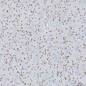 IHC staining of FFPE rat brain tissue with SAP130 antibody. HIER: boil tissue sections in pH8 EDTA for 20 min and allow to cool before testing.