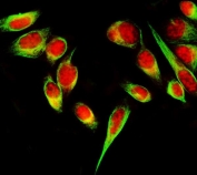 Immunofluorescent staining of FFPE human PC-3 cells with SAP130 antibody (red) and Alpha Tubulin mAb (green). HIER: steam section in pH6 citrate buffer for 20 min.