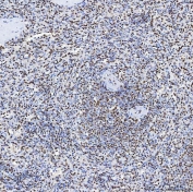 IHC staining of FFPE human spleen tissue with SAP130 antibody. HIER: boil tissue sections in pH8 EDTA for 20 min and allow to cool before testing.