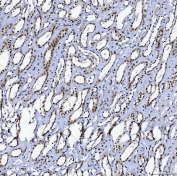 IHC staining of FFPE human placental tissue with SAP130 antibody. HIER: boil tissue sections in pH8 EDTA for 20 min and allow to cool before testing.
