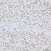 IHC staining of FFPE mouse brain tissue with SAP130 antibody. HIER: boil tissue sections in pH8 EDTA for 20 min and allow to cool before testing.