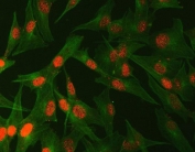 Immunofluorescent staining of FFPE human U-87 MG cells with Abelson interactor 2 antibody (red) and Beta Tubulin mAb (green). HIER: steam section in pH6 citrate buffer for 20 min.