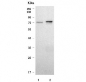 Western blot testing of 1) human 293T and 2) rat kidney tissue lysate with SLC6A18 antibody. Predicted molecular weight ~71 kDa.