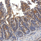 IHC staining of FFPE rat colon tissue with SLC20A1 antibody. HIER: boil tissue sections in pH8 EDTA for 20 min and allow to cool before testing.