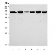 Western blot testing of 1) rat kidney, 2) rat brain, 3) rat C6, 4) mouse kidney, 5) mouse brain and 6) mouse Neuro-2a cell lysate with SLC20A1 antibody. Predicted molecular weight ~74 kDa, commonly observed at 74-95 kDa.