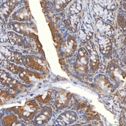 IHC staining of FFPE mouse colon tissue with SLC20A1 antibody. HIER: boil tissue sections in pH8 EDTA for 20 min and allow to cool before testing.