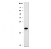 Western blot testing of human A431 cell lysate with CLDN1 antibody. Expected molecular weight: 20-23 kDa.